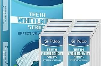 Diamond Smile vs kit Amazon : quel blanchiment dentaire choisir en 2026 ?